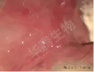 Cochlear Tissue Cannulation
